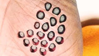 Trypophobia Trypophobia Trypophobia [upl. by Ennadroj234]