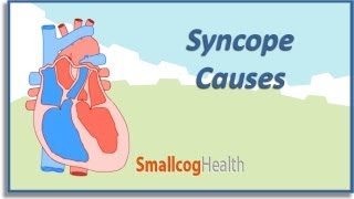 Syncope Causes [upl. by Enileuqkcaj]