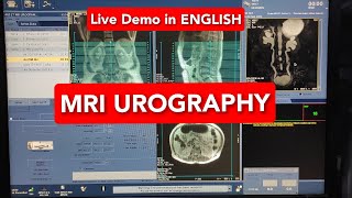 MRI Urography  English Subtitles [upl. by Oratnek]