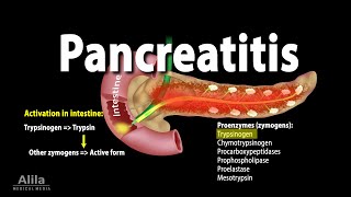 Pancreatitis Acute and Chronic Animation [upl. by Dleifniw]