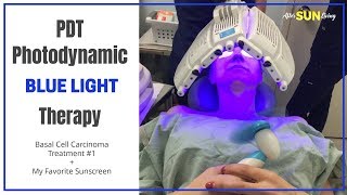 PDT PHOTODYNAMIC BLUE LIGHT THERAPY  Skin Cancer Treatment  Basal Cell Carcinoma  EP04 [upl. by Buderus]