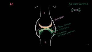 Osteoartrit ve Romatoid Artrit Patofizyolojisi Fen Bilimleri Sağlık ve Tıp [upl. by Areik566]