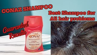 Conaz Shampoo benefits  Lotion Based Shampoo  Honest review [upl. by Ihcekn]