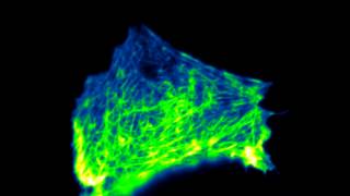 Effect of Latrunculin A on actin [upl. by Bogosian84]