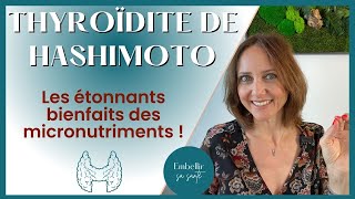 Hypothyroïdie d’Hashimoto régime alimentaire et solutions naturelles [upl. by Acnayb]