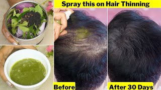 He Spray👆 this daily on Thinning Hair amp Bald AreasGot Thick Heavy Hair GrowthGet rid of Hair loss [upl. by Etiuqram]