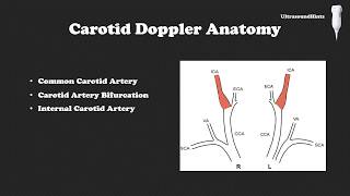 Basic Carotid Doppler Ultrasound Protocol [upl. by Beulah]