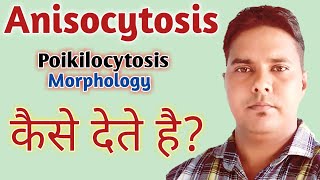 Anisocytosis in hindi  Poikilocytosis in hindi  Anisopoikilocytosis in hindi  RBC morphology [upl. by Floria172]