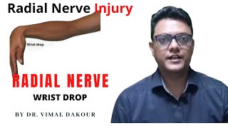 Radial Nerve Injury  Radial Nerve  Wrist Drop  By Dr Vimal Dakour [upl. by Almond]