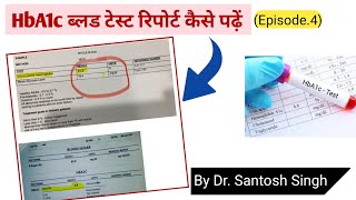 How To Read HBA1c Test Report  Glycosylated Hb  Dr Santosh Singh  Episode 4 [upl. by Eimmelc]