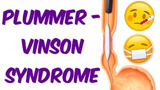 Plummer Vinson Syndrome in 6 mins [upl. by Tait]