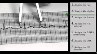 EKG Interpretation and Response SERIES Sinus Dysrhythmias [upl. by Akineg]