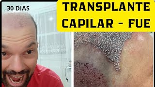 TRANSPLANTE CAPILAR  FUE APÓS 30 DIAS [upl. by Torrlow]