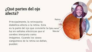 video retinopatía diabética [upl. by Sundstrom206]