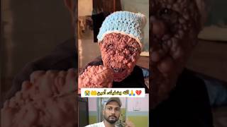 الله يشفيك، آمين🤲💔😭 islamicchanl viral shorts [upl. by Severn]