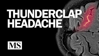 Thunderclap Headache [upl. by Elleinnad81]