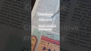 Celiac Disease  Celiac sprue  Gluten sensitive enteropathy gastroenterology glutenintolerance [upl. by Ponzo]