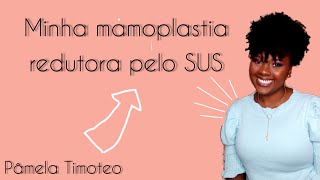 MAMOPLASTIA REDUTORA PELO SUS  COMO CONSEGUIR PÂMELA TIMOTEO [upl. by Nylehtak]