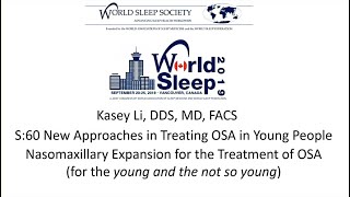 Kasey Li Maxillary expansion using endoscopicassistedsurgical expansion  World Sleep 2019 [upl. by Enuj367]