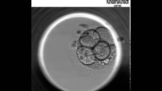 Die Embryo Entwicklung bis zur Blastozyste  Embryoskop [upl. by Jala]