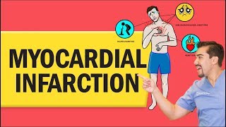 Myocardial Infarction Heart Attack for Nursing amp NCLEX [upl. by Trah]