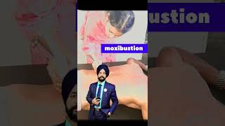 MoxibustionPrabh pain ramove Therapist solution foreverpunjabi [upl. by Mulligan118]