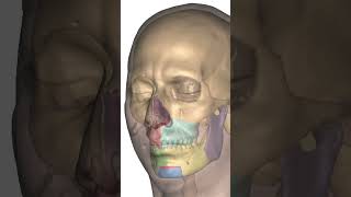 Counterclockwise bimaxillary Orthognathic jaw correction surgery [upl. by Mcnally556]