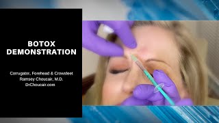 Botox® Demonstration Corrugators Forehead amp Crowsfeet  Ramsey Choucair MD  Ph 2143899797 [upl. by Drolyag]