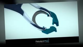 Palodent Plus for Class II [upl. by Henriette853]