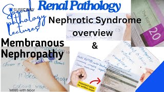 membranous nephropathy  nephrotic syndrome  renal pathology lectures  selflessmedicose [upl. by Ferretti]