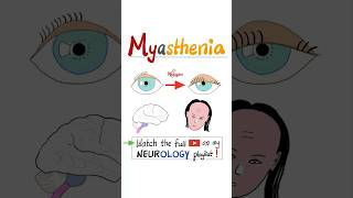 Myasthenia Gravis MG  Muscle Weakness Fatigue…science anatomy pathology health nurse mbbs [upl. by Aiclid]