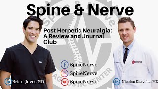 Post Herpetic Neuralgia A Review and Journal Club [upl. by Cyndia140]