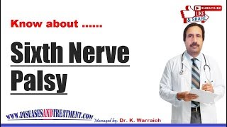 Sixth Nerve Palsy  Causes Diagnosis Symptoms Treatment Prognosis [upl. by Kirstin]