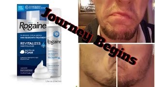 Minoxidil Beard  Minoxidil 5 for Beard Growth  The Journey Begins  FacialFuzzFridays [upl. by Alyehc153]