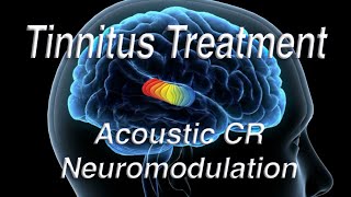 Tinnitus Treatment Using Acoustic Coordinated Reset Neuromodulation ACRN [upl. by Jelsma]