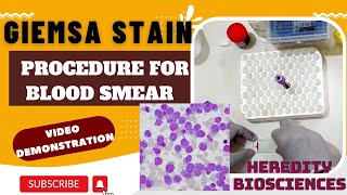 Giemsa Stain Procedure for Blood Smear hereditybioacademy7062 [upl. by Stanway]