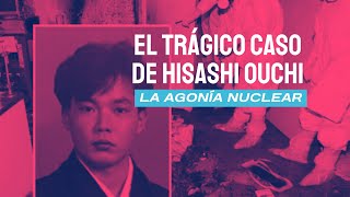 El trágico caso de Hisashi Ouchi La agonía nuclear [upl. by Adon]