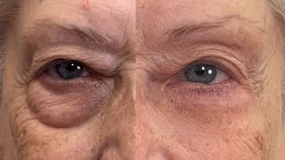 Get Rid of Eye Bags Instantly Eliminate Puffiness and Darkness 🚨 Fierce Aging with Nikol Johnson [upl. by Opalina]