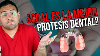 ¿NECESITAS PRÓTESIS DENTAL 👅 ¡Deberías ver este vídeo Ft Dentalk [upl. by Sandra]