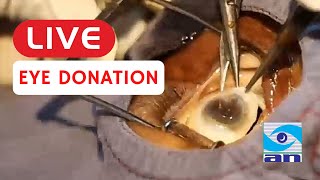 Live eye donation  ಕಣ್ಣಿನ ದಾನ ಲೈವ್  Abhishek Nethradhama [upl. by Lecroy]