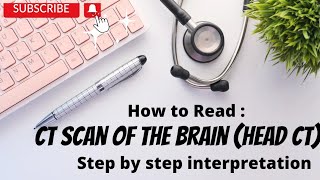 1 How to read a Head CT Scan [upl. by Cristiona]