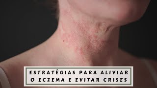 Eczema na Pele Como Controlar e Reduzir [upl. by Noellyn]