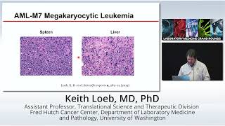 Erythroid and Megakaryoblastic Leukemia from Models to Targeted Therapy [upl. by Heidi999]