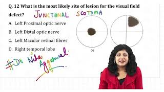 Junctional Scotoma  Dr Niha Aggarwal [upl. by Enomaj]