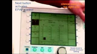 RESPIRATORY CARE Vision BiPAP Parameters [upl. by Tallu708]