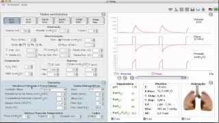 Modos em ventilação mecânica ACVCV [upl. by Ruperta]