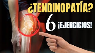 🟩TRATAMIENTO para la TENDINOPATÍA ROTULIANA Tendinitis ¡Prueba estos EJERCICIOS y deja el REPOSO [upl. by Anelaj622]