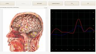 Biophilia Tracker X3 Demo [upl. by Annirak]