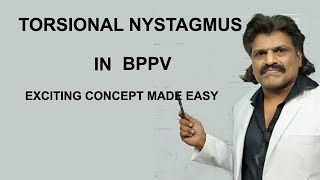 TORSIONAL NYSTAGMUS IN BPPV  EXCITING CONCEPT MADE EASY [upl. by Arty]