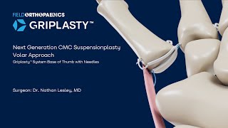 Griplasty System Volar Surgical Approach for CMC Suspensionplasty by Dr Nathan Lesley [upl. by Phillipp]